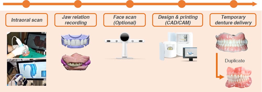 Digital denture workflow with JB Fork