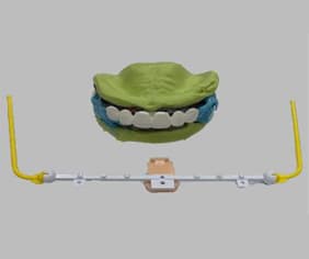 Completed JB Fork jaw relation and intraoral records