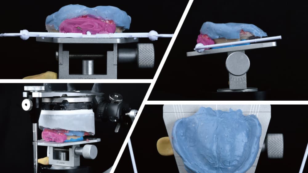 Articulator mounting based on POP Bow plane