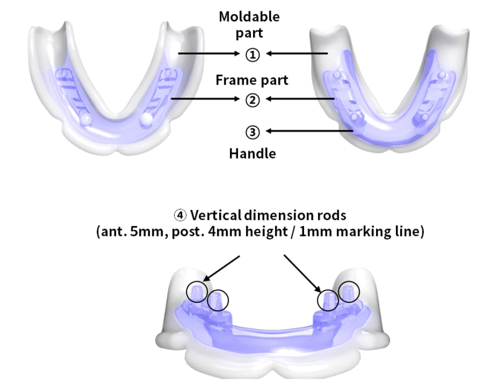 JB Tray mandibular structure with VD rods
