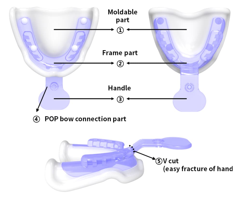 JB Tray maxillary structure