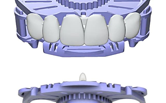 JB Fork Radi+ jaw-relation device