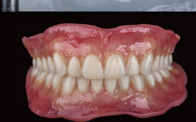 Finished definitive denture