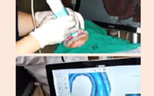 Chairside intraoral scan and digital arch model